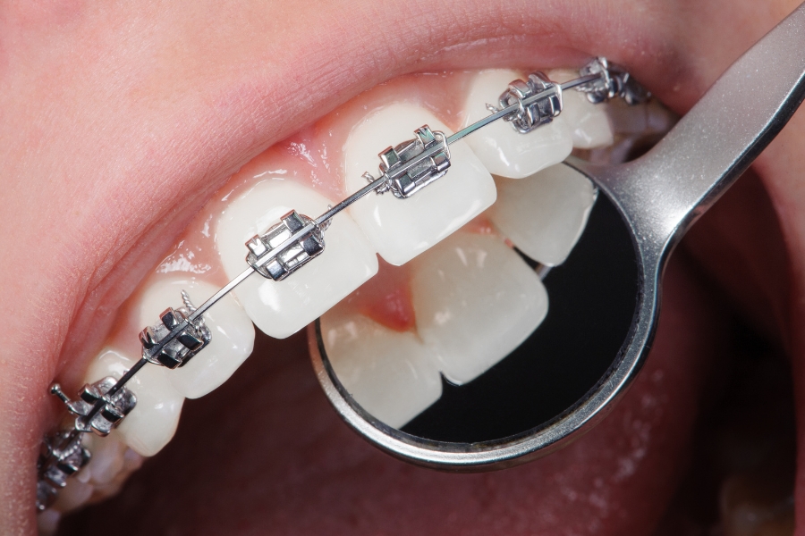 Orthodontics